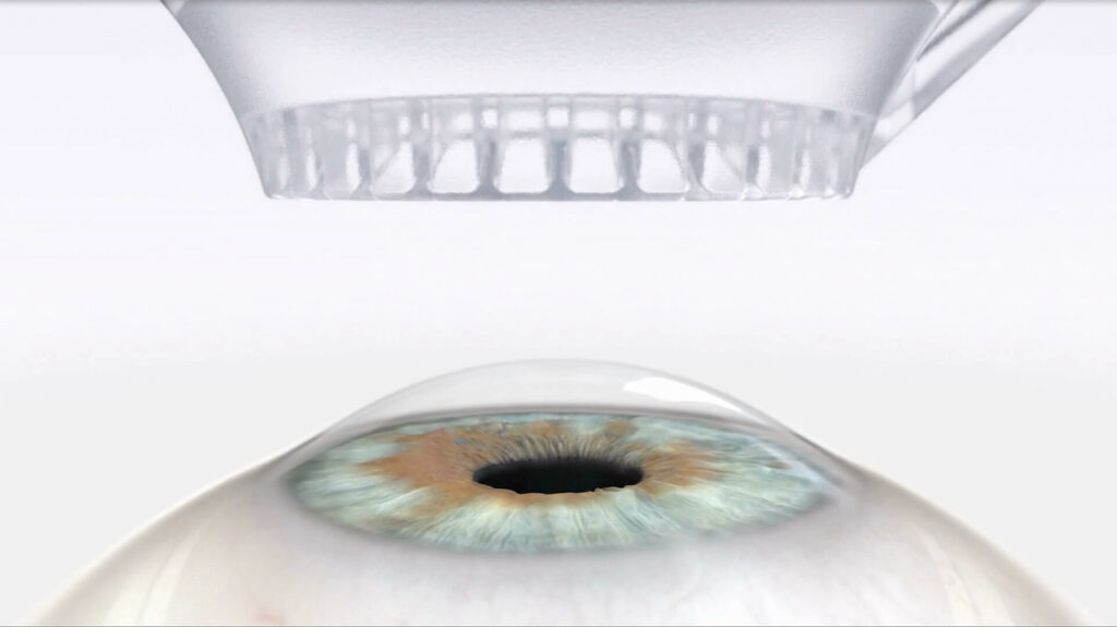 Smile Animation Video Poster